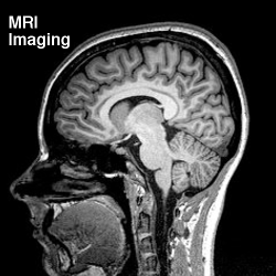 MRI Imaging